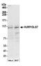 DLG Associated Protein 5 antibody, A300-852A, Bethyl Labs, Western Blot image 
