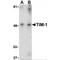 Hepatitis A Virus Cellular Receptor 1 antibody, MBS150460, MyBioSource, Western Blot image 