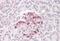 Suppressor Of Cytokine Signaling 4 antibody, GTX89892, GeneTex, Immunohistochemistry paraffin image 