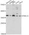 F-box/LRR-repeat protein 12 antibody, A14589, ABclonal Technology, Western Blot image 