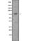 Rho Guanine Nucleotide Exchange Factor 4 antibody, PA5-68317, Invitrogen Antibodies, Western Blot image 