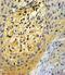 SPARC antibody, GTX81749, GeneTex, Immunohistochemistry paraffin image 