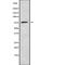 Coagulation Factor XIII B Chain antibody, abx215275, Abbexa, Western Blot image 