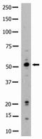 HCK Proto-Oncogene, Src Family Tyrosine Kinase antibody, AP14468PU-N, Origene, Western Blot image 