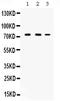 Cytochrome P450 Family 11 Subfamily A Member 1 antibody, PB9942, Boster Biological Technology, Western Blot image 