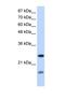 Signal Recognition Particle 14 antibody, NBP1-57413, Novus Biologicals, Western Blot image 