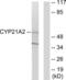 Cytochrome P450 Family 21 Subfamily A Member 2 antibody, LS-B9248, Lifespan Biosciences, Western Blot image 