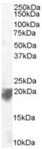 Vacuolar protein sorting-associated protein 29 antibody, ab10160, Abcam, Western Blot image 