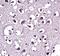 Lipoprotein Lipase antibody, A00316-1, Boster Biological Technology, Immunohistochemistry paraffin image 