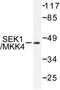 Mitogen-Activated Protein Kinase Kinase 4 antibody, LS-C176204, Lifespan Biosciences, Western Blot image 