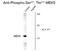 Mitogen-Activated Protein Kinase Kinase 5 antibody, GTX82655, GeneTex, Western Blot image 