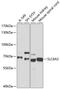 Solute Carrier Family 6 Member 2 antibody, GTX66236, GeneTex, Western Blot image 