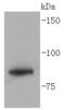 Glycogen Synthase 1 antibody, A03512-2, Boster Biological Technology, Western Blot image 