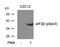 Eukaryotic Translation Initiation Factor 2 Subunit Beta antibody, PA5-37769, Invitrogen Antibodies, Western Blot image 