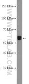 Transmembrane Protein 266 antibody, 26094-1-AP, Proteintech Group, Western Blot image 