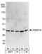 Proteasome 26S Subunit, Non-ATPase 14 antibody, A303-857A, Bethyl Labs, Western Blot image 
