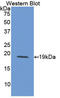 Interleukin 15 antibody, LS-C294843, Lifespan Biosciences, Western Blot image 