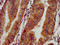 Nephrocystin 4 antibody, LS-C672534, Lifespan Biosciences, Immunohistochemistry paraffin image 