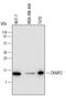 Cellular Retinoic Acid Binding Protein 2 antibody, AF5740, R&D Systems, Western Blot image 