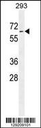 Phospholipase D Family Member 5 antibody, 55-939, ProSci, Western Blot image 