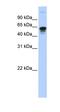 Regulator Of Microtubule Dynamics 3 antibody, orb325341, Biorbyt, Western Blot image 