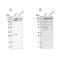 Sister chromatid cohesion protein PDS5 homolog A antibody, PA5-57755, Invitrogen Antibodies, Western Blot image 