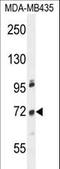 Zinc Finger Protein 510 antibody, LS-C160890, Lifespan Biosciences, Western Blot image 