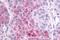 Lysophosphatidic Acid Receptor 4 antibody, NLS1895, Novus Biologicals, Immunohistochemistry paraffin image 