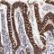 Amnion Associated Transmembrane Protein antibody, HPA000817, Atlas Antibodies, Immunohistochemistry frozen image 