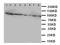 Coagulation Factor VIII antibody, LS-C313190, Lifespan Biosciences, Western Blot image 