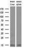 NADH:Ubiquinone Oxidoreductase Subunit A5 antibody, MA5-25767, Invitrogen Antibodies, Western Blot image 