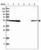 Interleukin 17 Receptor C antibody, NBP1-83112, Novus Biologicals, Western Blot image 