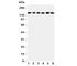 Thrombospondin 2 antibody, R30487, NSJ Bioreagents, Western Blot image 