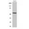 Cytochrome P450 Family 26 Subfamily A Member 1 antibody, LS-C382989, Lifespan Biosciences, Western Blot image 