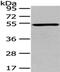 TSPY Like 1 antibody, PA5-51264, Invitrogen Antibodies, Western Blot image 