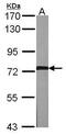 G Protein-Coupled Receptor Kinase 2 antibody, PA5-27480, Invitrogen Antibodies, Western Blot image 