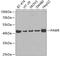 Pro-Apoptotic WT1 Regulator antibody, 18-925, ProSci, Western Blot image 