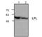 Lipoprotein Lipase antibody, NBP1-50735, Novus Biologicals, Western Blot image 