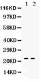 Lipocalin 2 antibody, PA5-79590, Invitrogen Antibodies, Western Blot image 