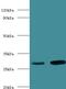 Carbonic Anhydrase 1 antibody, MBS1488191, MyBioSource, Western Blot image 