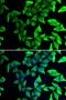 Visinin Like 1 antibody, LS-C346177, Lifespan Biosciences, Immunofluorescence image 