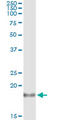 Interleukin 1 Receptor Antagonist antibody, LS-C139122, Lifespan Biosciences, Immunoprecipitation image 