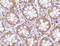 RASD Family Member 2 antibody, 4361, ProSci, Immunohistochemistry paraffin image 