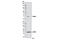 Proteasome Subunit Beta 7 antibody, 12197S, Cell Signaling Technology, Western Blot image 