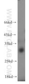 C11orf49 antibody, 20195-1-AP, Proteintech Group, Western Blot image 