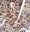 CD38 Molecule antibody, GTX81962, GeneTex, Immunohistochemistry paraffin image 