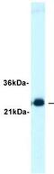 RAB3A, Member RAS Oncogene Family antibody, GTX77706, GeneTex, Western Blot image 