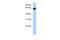 Zinc Finger Protein 100 antibody, PA5-41241, Invitrogen Antibodies, Western Blot image 