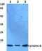 Cystatin-B antibody, GTX66627, GeneTex, Western Blot image 