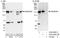 Ankyrin Repeat Domain 50 antibody, A302-999A, Bethyl Labs, Western Blot image 